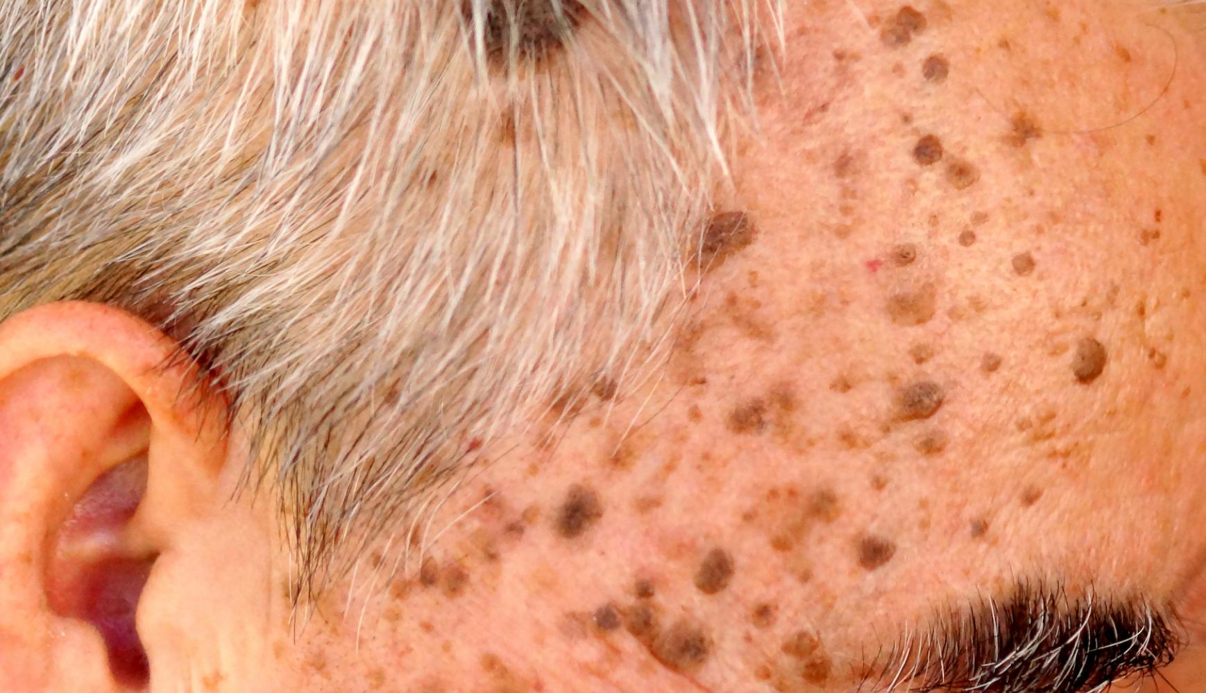 skin