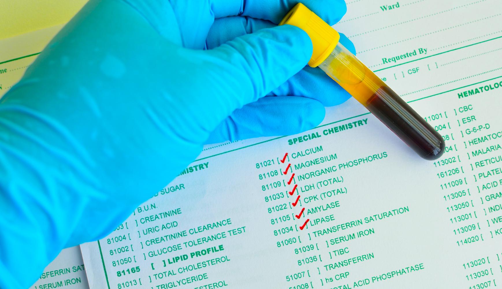 blood test results